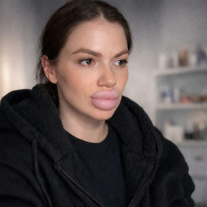 Removable Silicone FX Lips – Soft Reusable Fake Lips