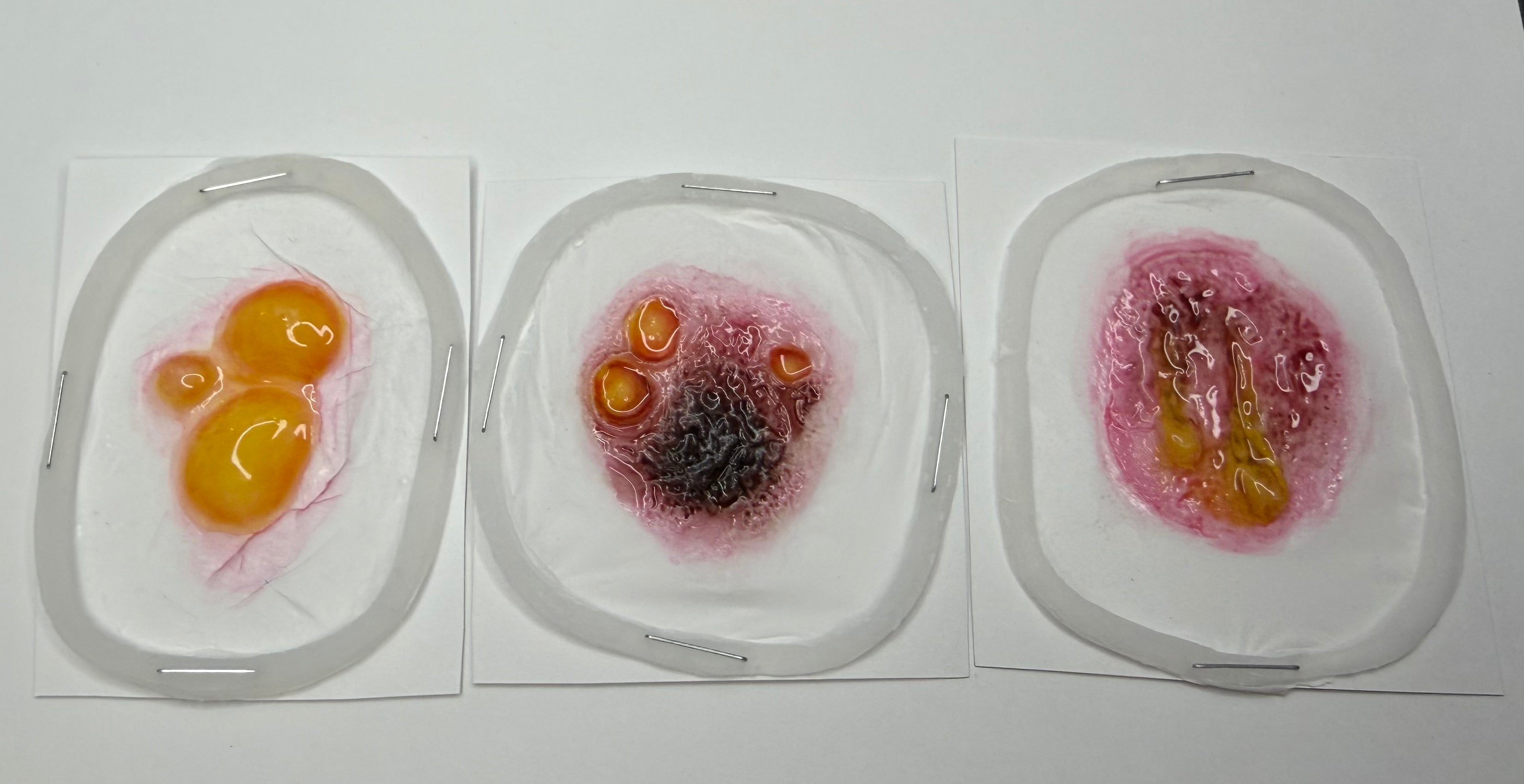 Professional Encapsulated Silicone Burn Prosthetic Set (3 Pieces)